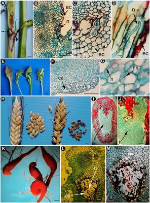 Anatomical Alterations in Plant Tissues Induced by Plant-Parasitic Nematodes